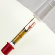 How Reliable Are Disposable Breathalysers Compared to Digital Units